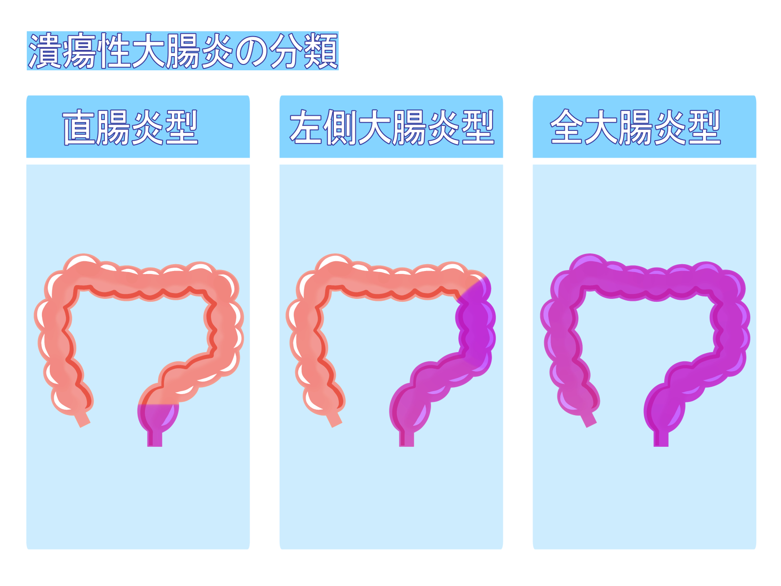 クローン病との違いから分かる——潰瘍性大腸炎に「腸壁を補修する栄養素」が届いていない理由