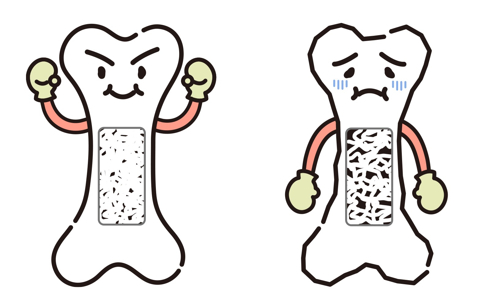 カルシウムが骨に届かない理由——ビタミンK2と動脈石灰化・骨粗鬆症の意外な関係